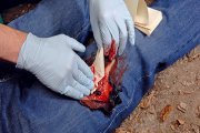 Leg bleed