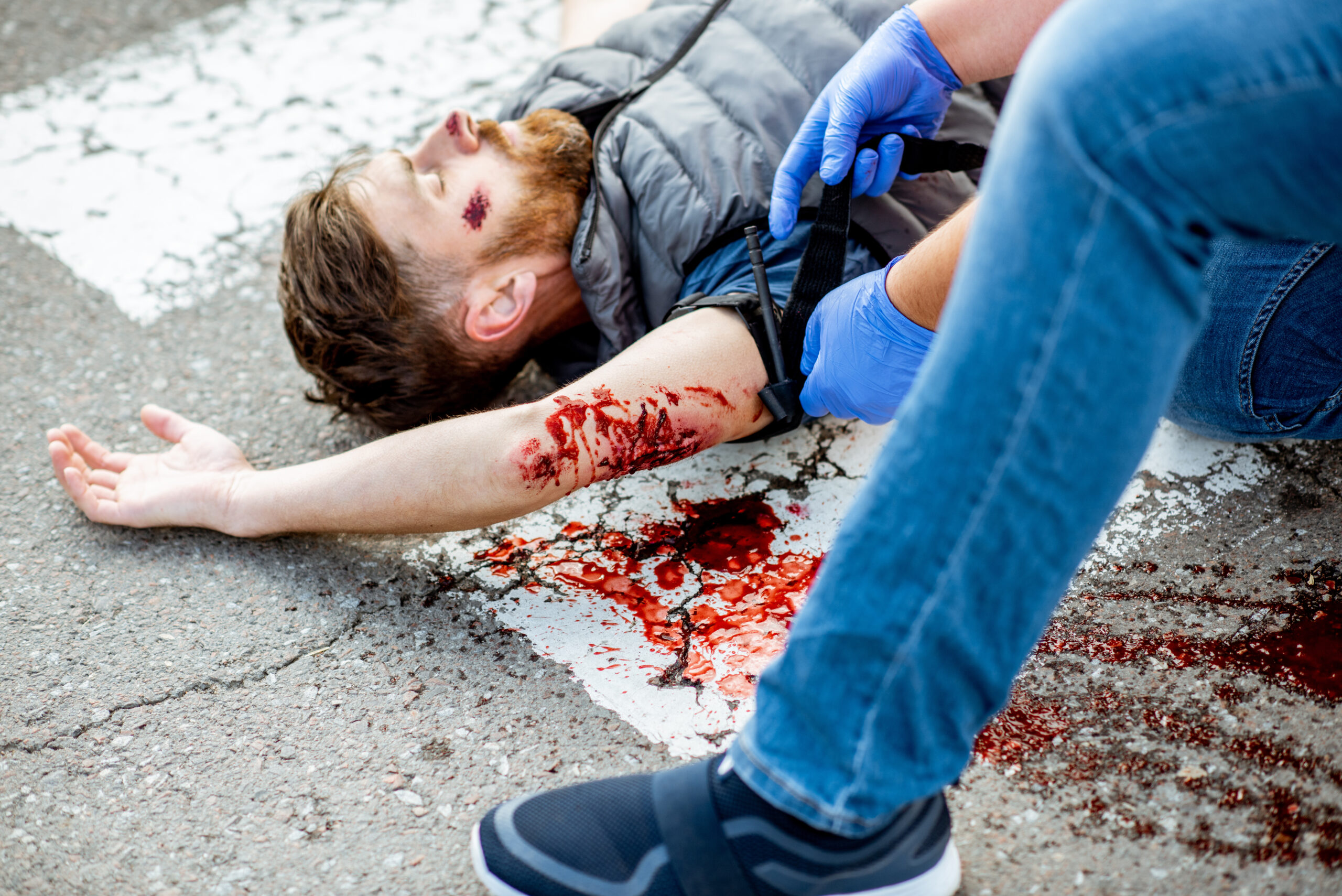 Life threatening bleeding control